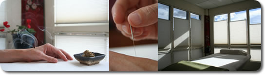 Treatment room, moxa and needle